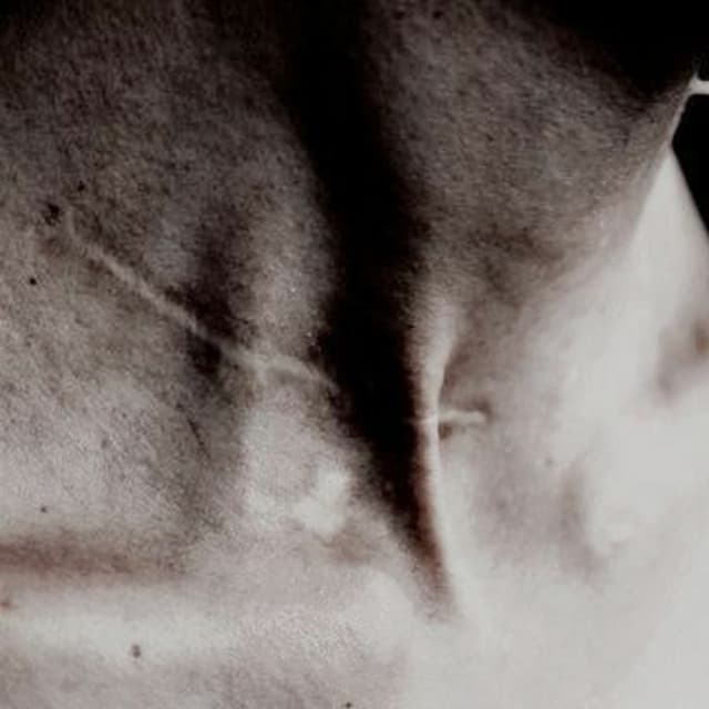 beauty marks