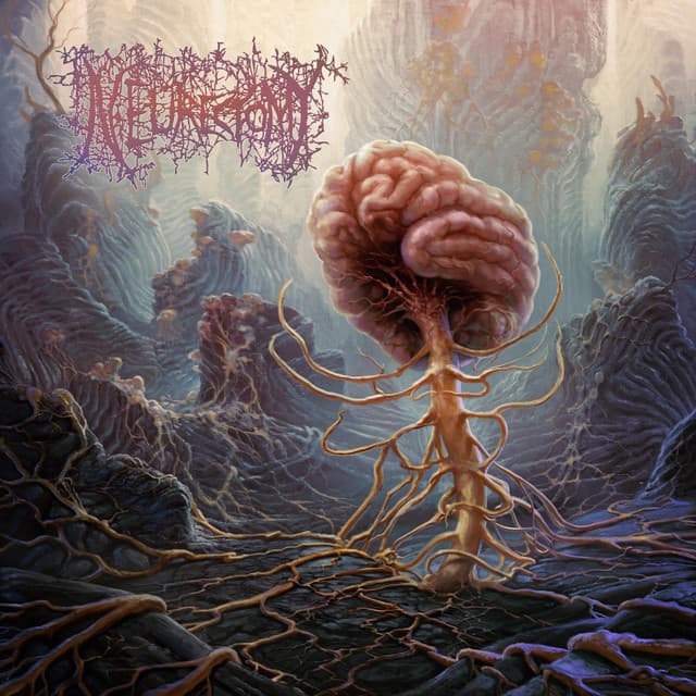 Neurectomy