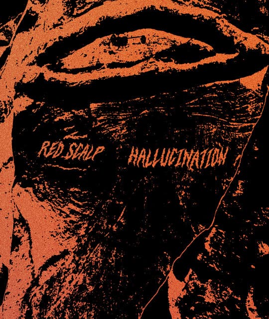 Red Scalp