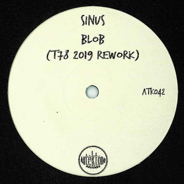 Sinus