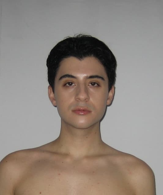 Steven Morea