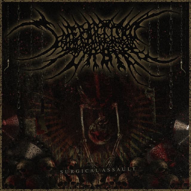 The Partisan Turbine