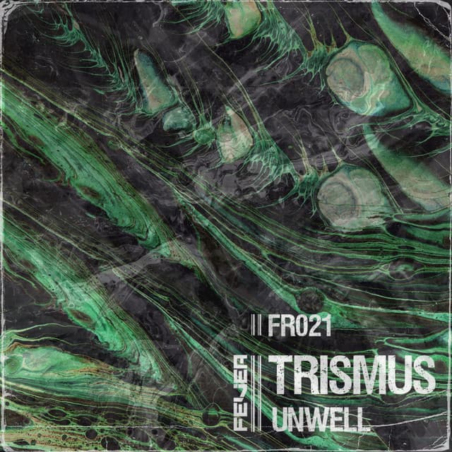 Trismus